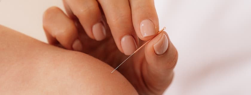 does medicare cover acupuncture
